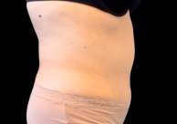 B&A