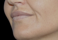 B&A
