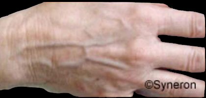 Skin Rejuvenation Before & After Patient #1231