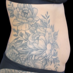 Liposuction Abdomen Before & After Patient #2803