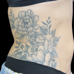 Liposuction Abdomen Before & After Patient #2803